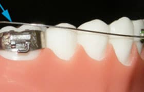 Loose Wire